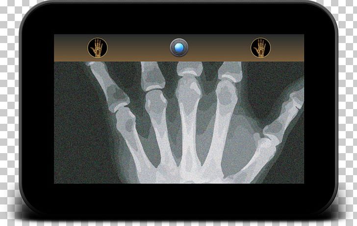 X-ray Military Technology Medical Imaging Renewable Energy PNG, Clipart, Bowers Wilkins, Con Artist, Finger, Hand, Joint Free PNG Download