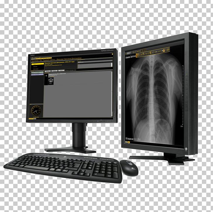 Health Technology System Computer Hardware Medicine PNG, Clipart, Computer Hardware, Computer Monitor Accessory, Dentistry, Electronic Device, Electronics Free PNG Download