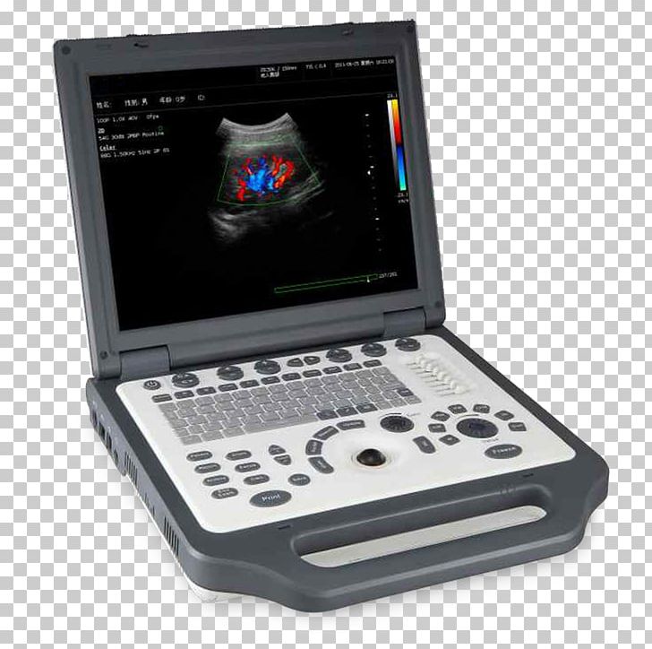 Ultrasonography Ultrasound Doppler Echocardiography Medical Equipment Medicine PNG, Clipart, Doppler Echocardiography, Electronic Device, Electronics, Laptop, Medi Free PNG Download