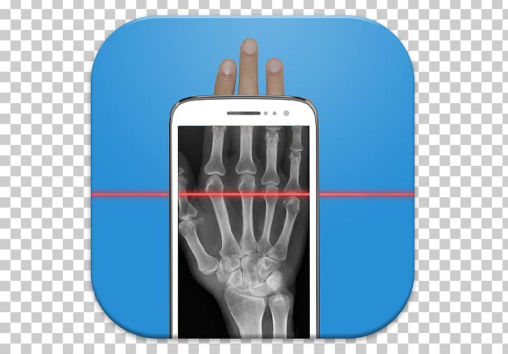 Xray Scanner Prank X-ray Scanner Prank Practical Joke Scanner PNG, Clipart, Android, Backscatter Xray, Download, Finger, Full Body Scanner Free PNG Download