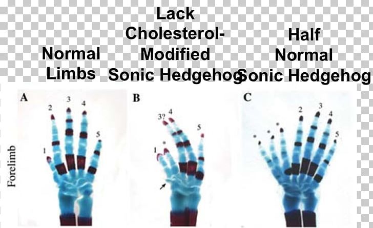 Sonic Hedgehog GLI3 Mouse Hedgehog Signaling Pathway Polydactyly PNG, Clipart, Animals, Blue, Cell, Developmental Biology, Embryo Free PNG Download