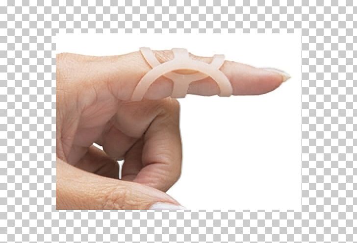 Thumb Spica Splint Finger Arthritis PNG, Clipart, Arthritis, Ear, Finger, Hand, Hand Model Free PNG Download