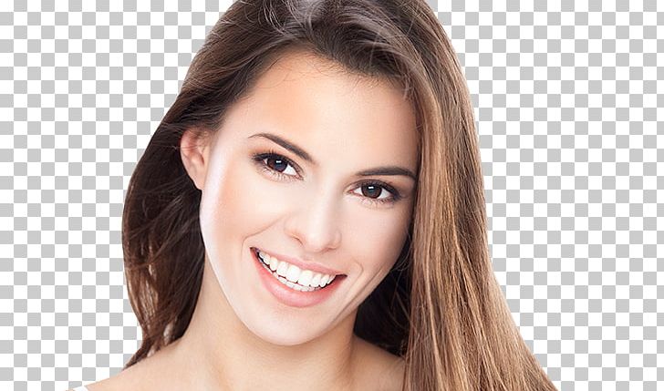 Dental Braces Clear Aligners Dentistry Orthodontics Tooth PNG, Clipart, Beauty, Brown Hair, Cheek, Chin, Clear Aligners Free PNG Download