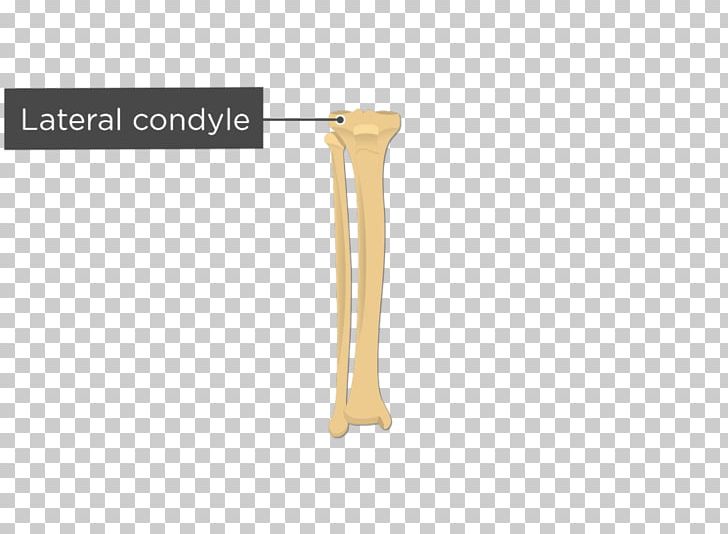 Lateral Condyle Of Tibia Fibula Medial Condyle Of Tibia Anatomy PNG, Clipart, Anatomy, Angle, Bone, Bone Fracture, Condyle Free PNG Download