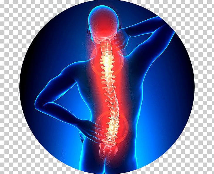 Vertebral Column Back Pain Neck Pain Physical Therapy Spinal Stenosis PNG, Clipart, Ache, Acute Pain, Back Pain, Chiropractic, Chronic Pain Free PNG Download
