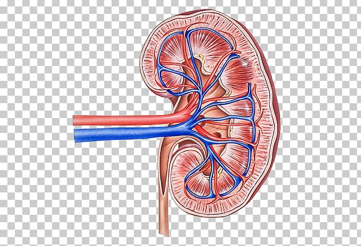 Renal Cell Carcinoma Chronic Kidney Disease (ckd) Kidney Cancer PNG, Clipart, Blood, Blood Vessel, Cancer, Cancer Cell, Cell Free PNG Download