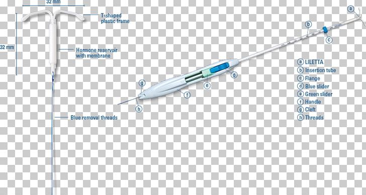 Progestin IUD Intrauterine Device Birth Control Copper IUDs Levonorgestrel PNG, Clipart, Angle, Area, Birth Control, Birth Control Implant, Copper Iuds Free PNG Download