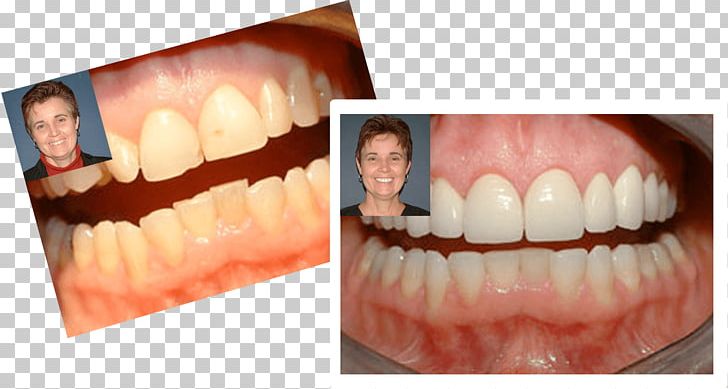 Markham PNG, Clipart, Chin, Cosmetic Dentistry, Dental Smile, Dentist, Dentistry Free PNG Download