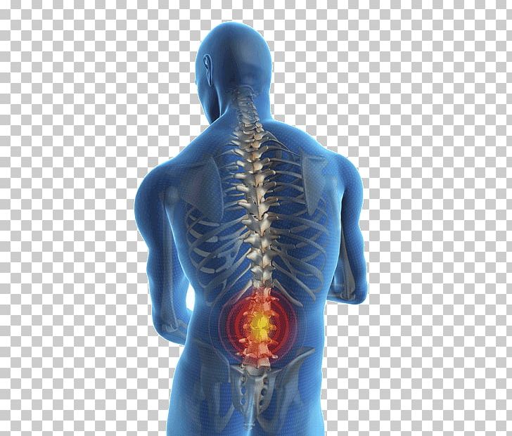Low Back Pain Back Injury Human Back Pain Management PNG, Clipart, Ache, Arm, Back, Back Pain, Cobalt Blue Free PNG Download