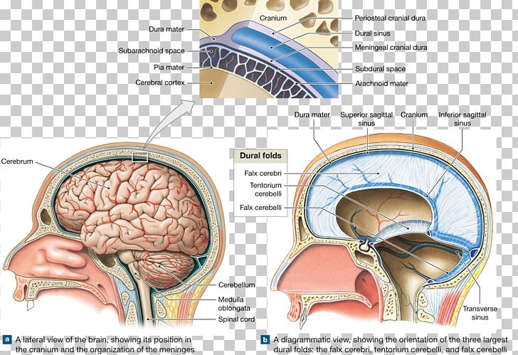 Brain Meninges Skull Cranial Cavity Anatomy PNG, Clipart, Anatomy, Brain, Central Nervous System, Cerebral Hemisphere, Cerebrospinal Fluid Free PNG Download