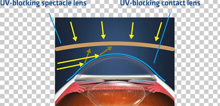 Johnson & Johnson Contact Lenses Ultraviolet Glasses PNG, Clipart, Acuvue, Angle, Brand, Contact Lenses, Eye Free PNG Download