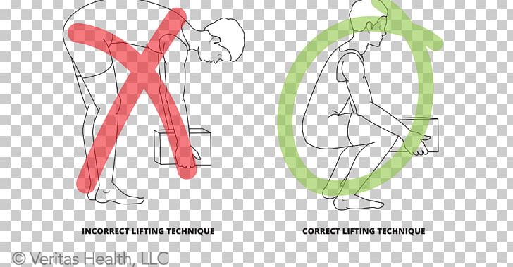 Back Pain Olympic Weightlifting Human Back Back Injury Safety PNG, Clipart, Abdomen, Angle, Arm, Bodybuilding, Cartoon Free PNG Download