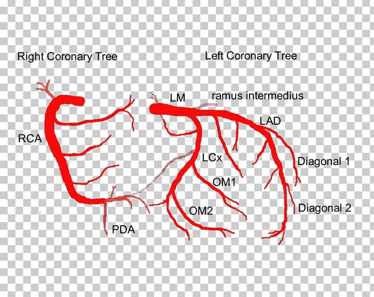 Coronary Arteries Anatomy Coronary Circulation Anterior Interventricular Branch Of Left Coronary Artery Heart PNG, Clipart, Angiography, Angle, Area, Art, Cardiac Catheterization Free PNG Download