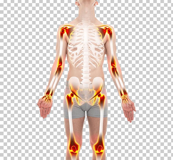 Rheumatoid Arthritis Ache Joint Homo Sapiens PNG, Clipart, Abdomen, Ache, Anatomy, Ankle, Arm Free PNG Download