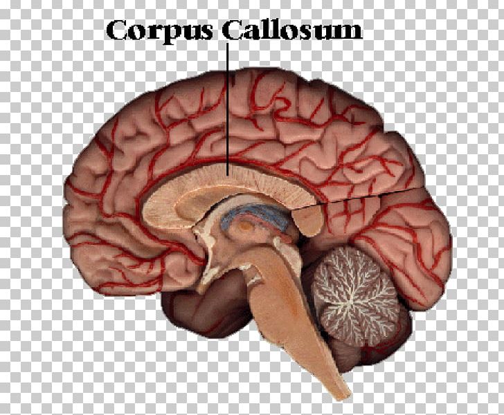 Corpus Callosum Brain Corpus Callosotomy Cerebral Hemisphere Human Body PNG, Clipart, Agenesis Of The Corpus Callosum, Anatomy, Axon, Brain, Cerebral Hemisphere Free PNG Download