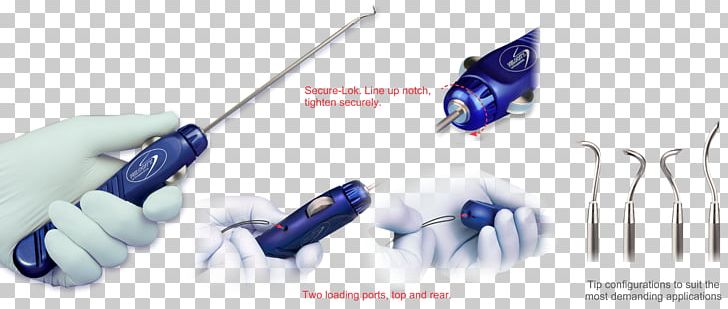 Medical Glove Surgical Suture Arthroscopy Surgery Hernia Repair PNG, Clipart, Acetabular Labrum, Arthrex, Arthroscopy, Blue, Glenoid Labrum Free PNG Download