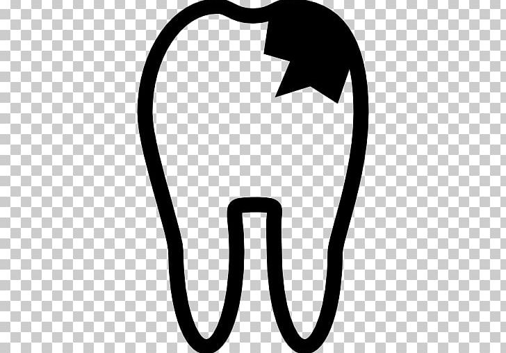 Dentistry Tooth Decay Human Tooth PNG, Clipart, Black, Black And White, Computer Icons, Dental Prosthesis, Dentist Free PNG Download