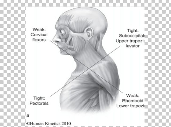 Impingement Syndrome Forward Head Posture Physical Therapy PNG, Clipart, Angle, Arm, Art, Back Pain, Black And White Free PNG Download