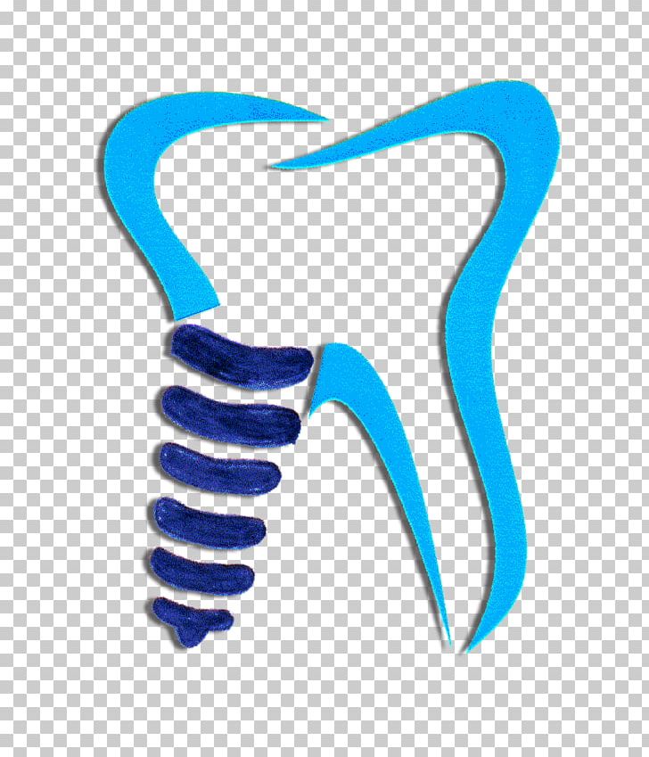 Dentistry Dental Implant Tooth Share A Smile Clinic PNG, Clipart, Art, Clinic, Delhi, Dental, Dental Floss Free PNG Download