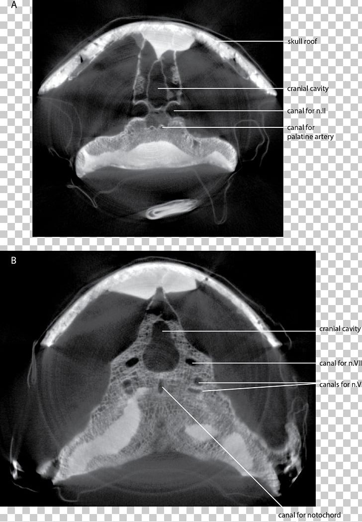 Computed Tomography Dipnorhynchus Skull Lungfish Endocast PNG, Clipart, Black And White, Computed Tomography, Devonian, Jaw, Lungfish Free PNG Download