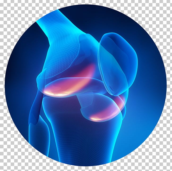 Knee Pain Bone Pain Joint PNG, Clipart, Ache, Arthritis, Bone, Bone Pain, Clinic Free PNG Download