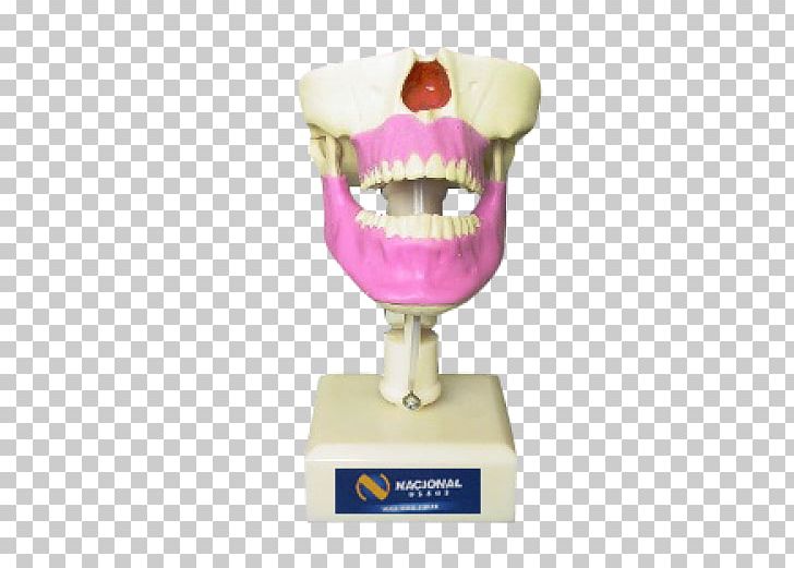 Maxilla Dentistry Alaleuanluu Jaw Surgery PNG, Clipart, Alaleuanluu, Anatomy, Dentistry, Gums, Human Skull Free PNG Download