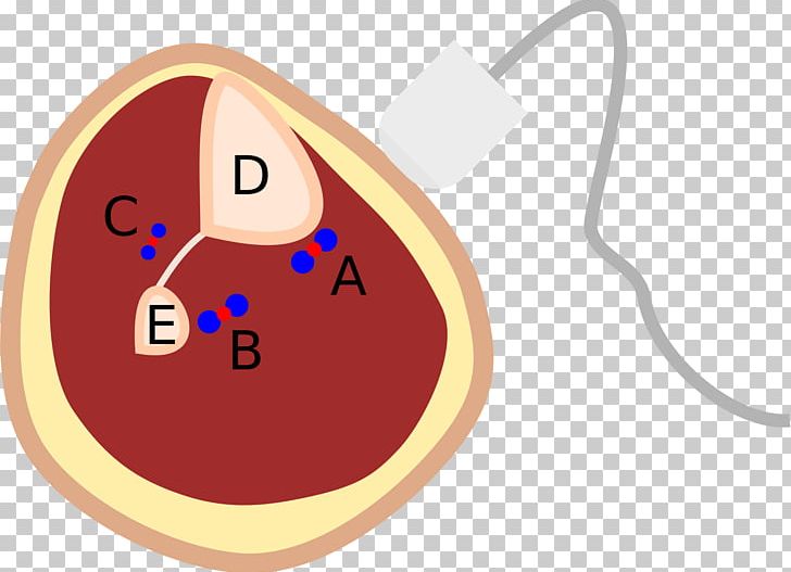 Calf Posterior Tibial Artery Fibular Artery Anatomy PNG, Clipart, Anatomy, Anterior Tibial Artery, Artery, Axial Skeleton, Calf Free PNG Download