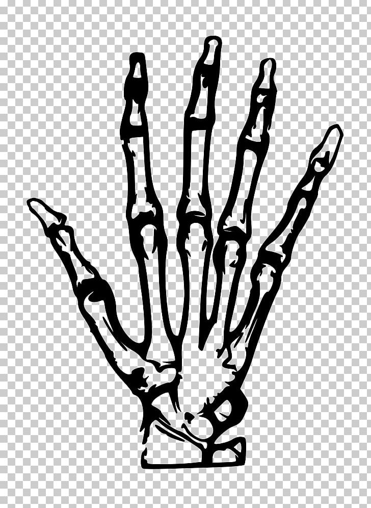 X-ray PNG, Clipart, Arm, Black, Black And White, Branch, Coloring Book Free PNG Download