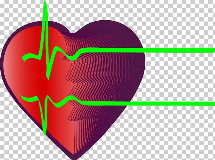 Electrocardiography Heart Rate Myocardial Infarction Coronary Artery Disease PNG, Clipart, Background Green, Diagnose, Disease, Green, Green Apple Free PNG Download