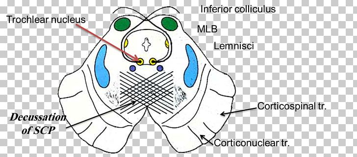 Inferior Colliculus Trochlear Nerve Superior Colliculus Midbrain Trochlear Nucleus PNG, Clipart, Anatomy, Angle, Area, Art, Cartoon Free PNG Download