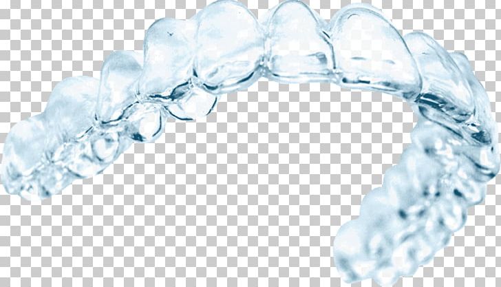 Clear Aligners Orthodontics Dentistry Dental Braces PNG, Clipart, Body Jewelry, Brace, Bracelet, Clear Aligners, Crowding Of Teeth Free PNG Download