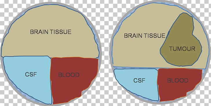 Doktryna Monro-Kelliego Brain Cerebrospinal Fluid Blood Hypothesis PNG, Clipart, Area, Blood, Brain, Cerebrospinal Fluid, Circle Free PNG Download