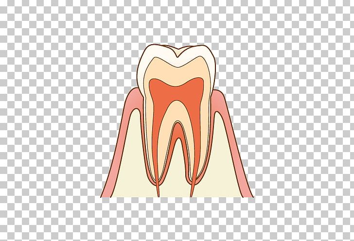 Tooth Decay Dentist 歯科 Therapy PNG, Clipart, Ache, Clinic, Dentin, Dentin Hypersensitivity, Dentist Free PNG Download