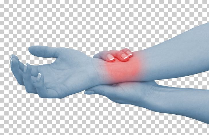 Wrist Pain Hand Carpal Tunnel Syndrome Sprain PNG, Clipart, Arm, Carpal Tunnel, Carpal Tunnel Syndrome, Elbow, Finger Free PNG Download