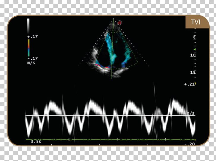 Ultrasonography Tissue Doppler Echocardiography Ultrasound Esaote Technology PNG, Clipart, Advance, Electronic Device, Electronics, Gadget, Magnetic Resonance Imaging Free PNG Download