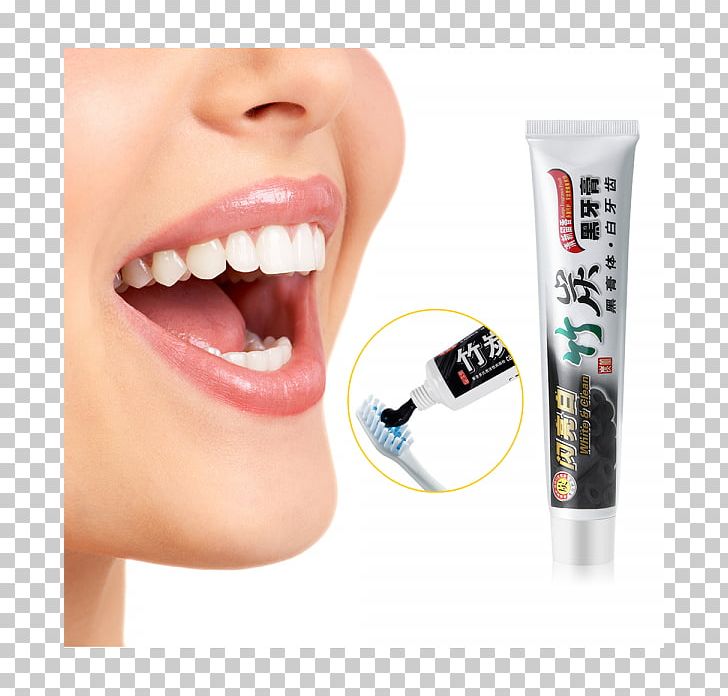 Electric Toothbrush Alexandria Total Dentistry Teeth Cleaning PNG, Clipart, Bruxism, Cheek, Chin, Dentist, Dentistry Free PNG Download