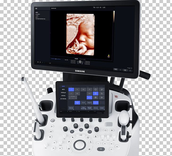 Ultrasonography Samsung Medison Ultrasound System PNG, Clipart, Contrast, Electronics, Gadget, Gynaecology, Gynecology Free PNG Download