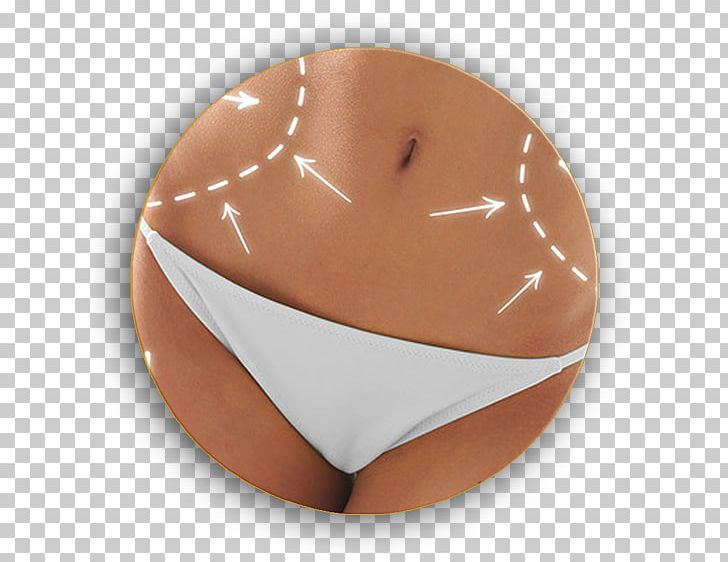 Plastic Surgery Surgeon Liposuction Body Contouring PNG, Clipart, Abdominoplasty, Aesthetic Plastic Surgery, Body Contouring, Chocolate, Human Body Free PNG Download