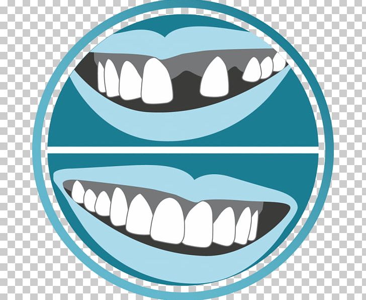 Tooth Smile Ewan Bramley Dental Care Mouth Dentist PNG, Clipart, Brace, Cosmetic Dentistry, Dental Care, Dental Implant, Dentist Free PNG Download