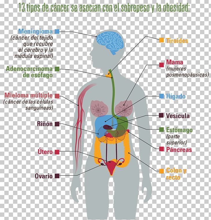 Centers For Disease Control And Prevention Obesity And Cancer Overweight PNG, Clipart, Abdomen, Angle, Arm, Cancer, Cancer Prevention Free PNG Download