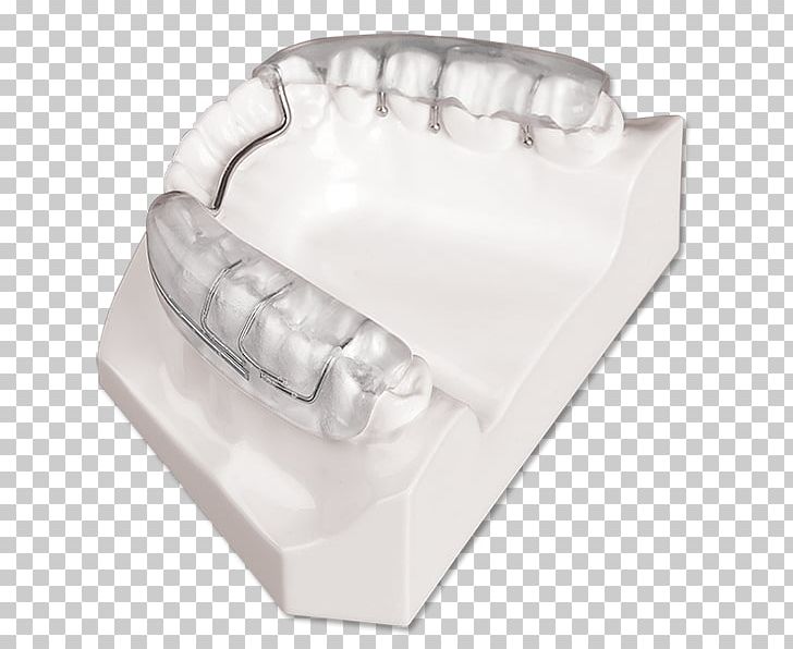 Mouthguard Splint Mandible Tooth Jaw PNG, Clipart, Dorsal Fin, Dynaflex, Hand, Home Appliance, Jaw Free PNG Download