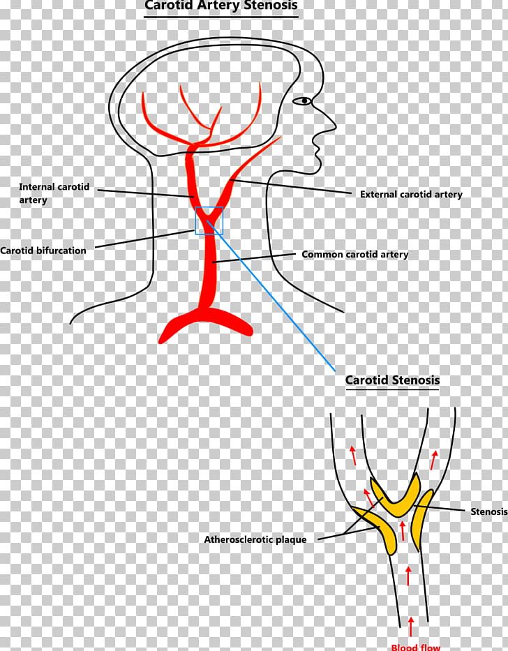 Organism Point PNG, Clipart, Angle, Area, Artery, Clog, Diagram Free PNG Download