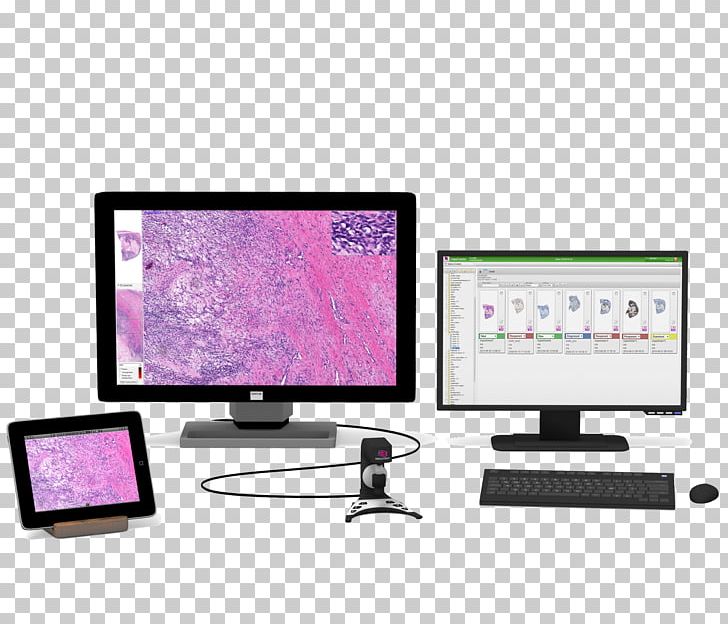 Computer Monitors Digital Pathology Digital Data PNG, Clipart, Clinic, Close, Computer, Computer Monitor, Computer Monitor Accessory Free PNG Download