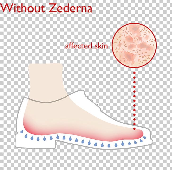 Foot Odor Foot Odor Shoe Insert PNG, Clipart, Area, Barefoot, Boot, Brand, Diagram Free PNG Download