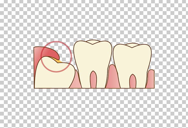 Wisdom Tooth Dentist 歯科 Dental Extraction PNG, Clipart, Dental Extraction, Dental Surgery, Dentist, Dentures, Disease Free PNG Download