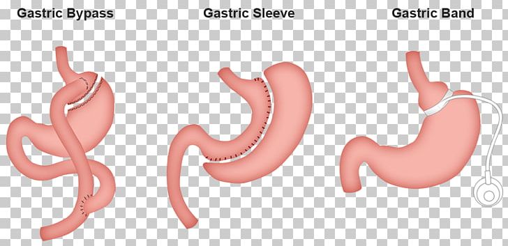 Thumb Pink M Jaw Mouth PNG, Clipart, Art, Ear, Finger, Gastric, Hand Free PNG Download