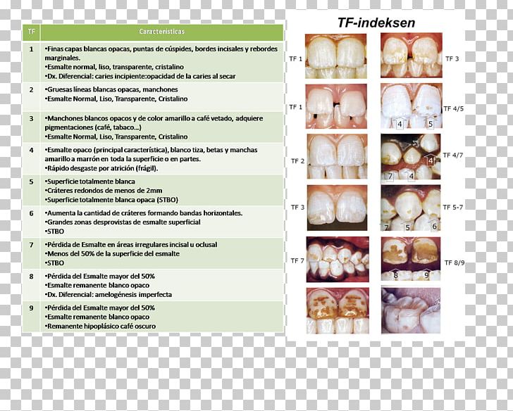 Advertising Dental Fluorosis Dentistry Brochure PNG, Clipart, Advertising, Brochure, Dental Fluorosis, Dentistry, Indice Free PNG Download