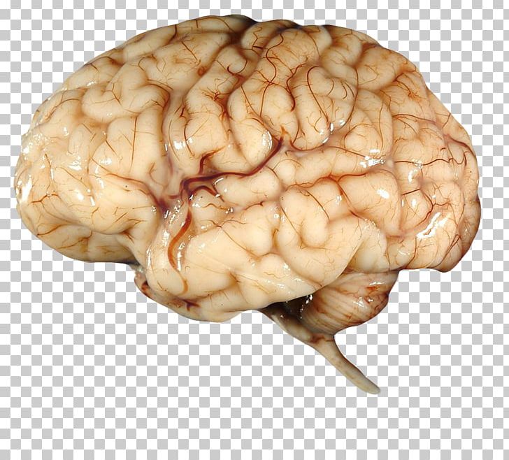 Brain PNG, Clipart, Brain, Brains, Brain Thrombosis, Brain Vector, Cartoon Brain Free PNG Download