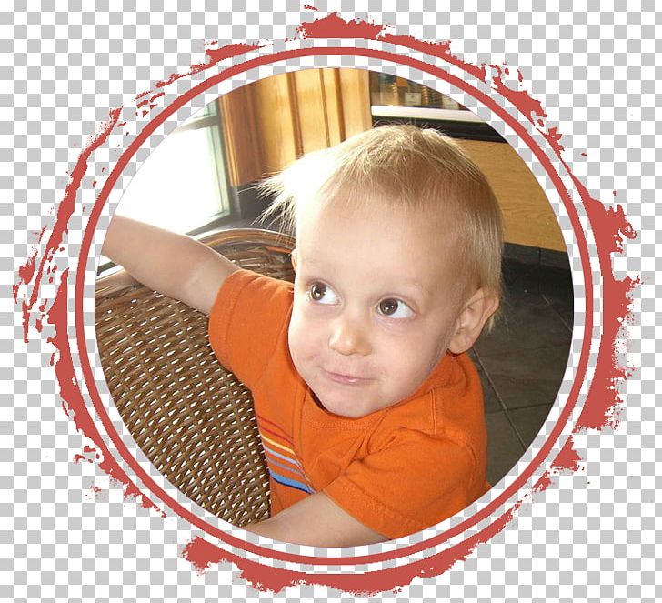 Child Krabbe Disease Toddler Leukodystrophy PNG, Clipart,  Free PNG Download