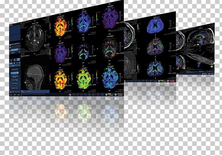 Magnetic Resonance Imaging Toshiba Canon Medical Systems Corporation MRI-scanner PNG, Clipart, 1 5 T, 5 T, Brand, Campo, Canon Free PNG Download